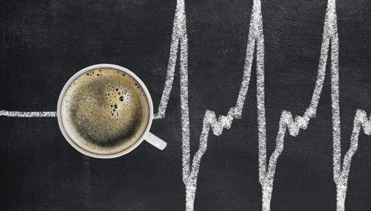 WHAT MAKES ESPRESSO COFFEE UNIQUE? (Updated 2025)